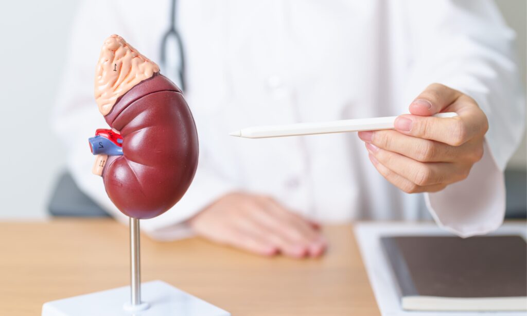 Pheochromocytoma