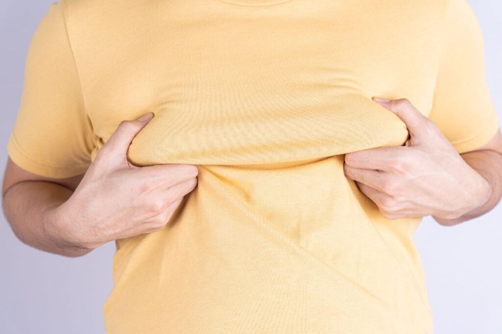 Enlargement of Breasts in Males (Gynecomastia)