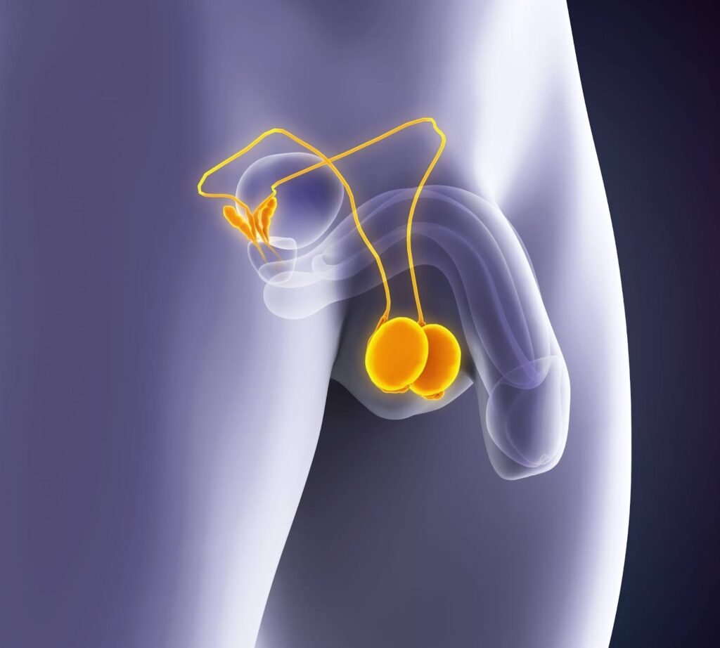 Hypogonadism