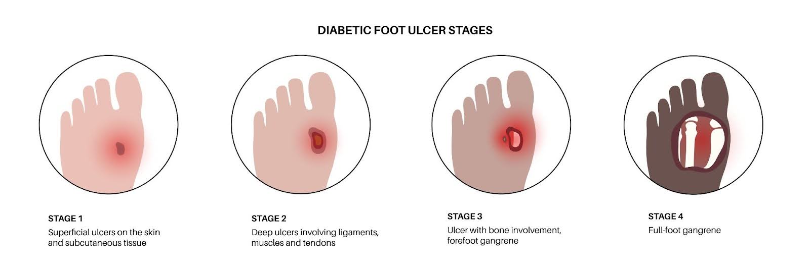 Fluid Retention and Inflammation