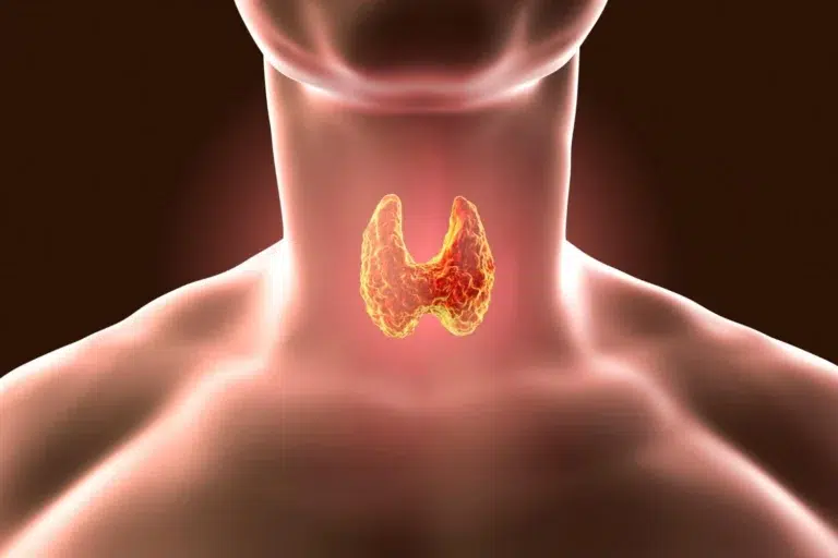 Understanding thyroid conditions that need treatment